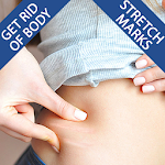 Cover Image of Descargar Get Rid of Body Stretch Marks 7.5 APK