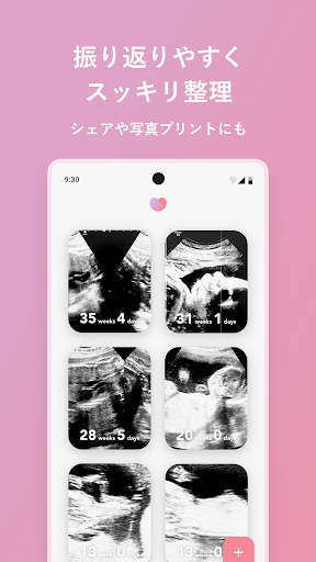 エコー写真　スキャンして簡単整理！ screenshot 2
