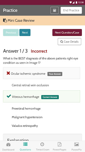 OptoPrep - Study for NBEO® PII Screen 2