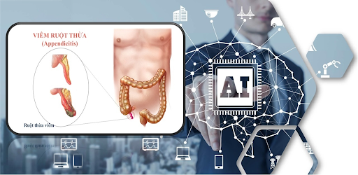 AIDAC (AI for Appendicitis)