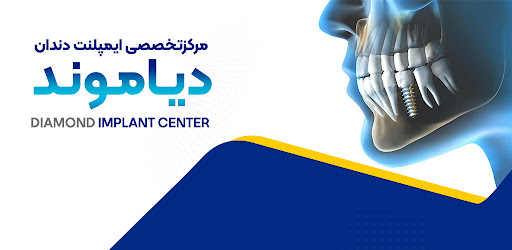 Android application مرکز ایمپلنت دندان دیاموند screenshort