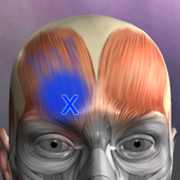 Icon image Muscle Trigger Point Anatomy
