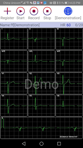aECG Screen 2