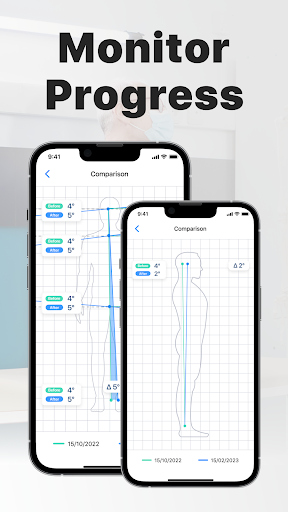 Posture Screen: Spine Analysis Screen 2