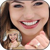 Braces Teeth Selfie Camera icon