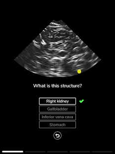 Deepscope Ultrasound Simulator Screenshot