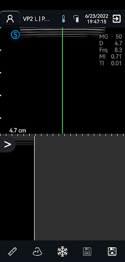 VP2 Screen 3