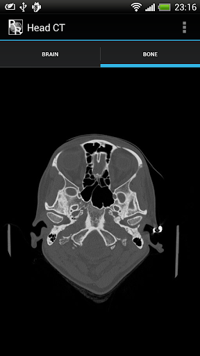 RadRevision Anatomy on CT
