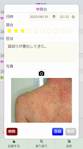 あっとレコ　かゆみ、炎症、つらいアレルギーと向き合う Screen 3