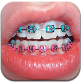 Real Braces Booth HD Studio icon