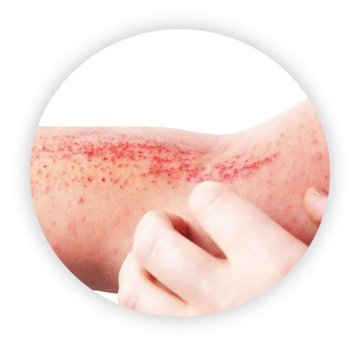 Managing Atopic Dermatitis logo