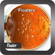 Recognize Floater Disease