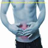 Appendicitis & Laparoscopic Surgery Procedures icon