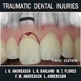 Traumatic Dental Injuries icon