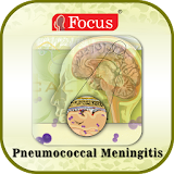 Pneumococcal meningitis icon