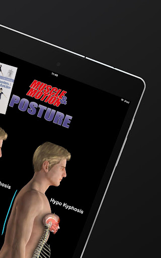 Screenshot of Posture by Muscle & Motion