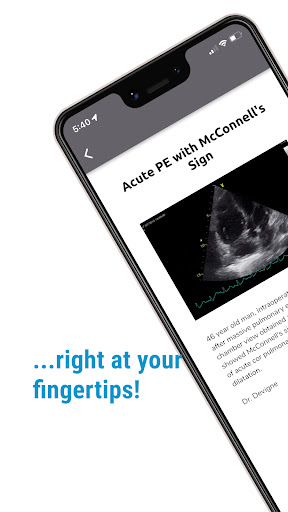 The POCUS Atlas Screen 2