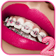 Teeth Braces App 2 Download on Windows