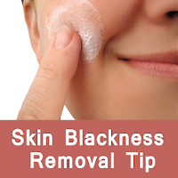 Skin Blackness Removal Tip-कालापन दूर करने के उपाय