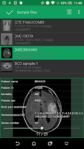 DroidRender - 3D DICOM viewer