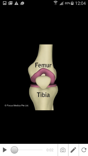 Osteoarthritis Screen 3