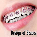 Design of Braces icon