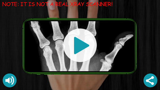 Android application X-Ray Scanner Simulator Prank screenshort