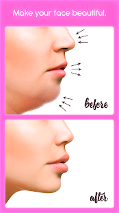 Rhinoplasty  APK screenshots 1