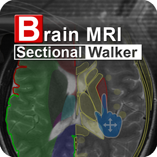 Brain MRI Sectional Wlker