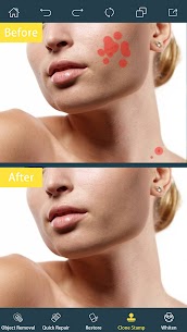 Photo Retouch- Object Removal APK for Android Download 2