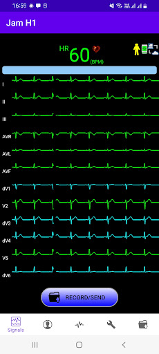Android application JamH1 ECG Analyser screenshort