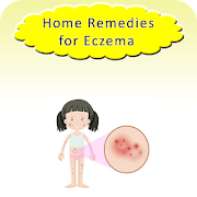 Home Remedies for Eczema
