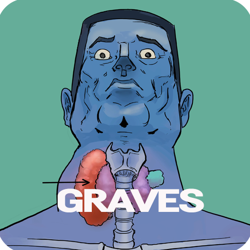 Graves Disease