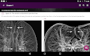 screenshot of Chest X-Ray DEMO