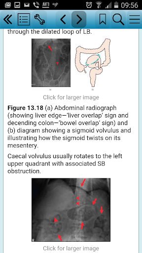 ABC of Emergency Radiology, 3e