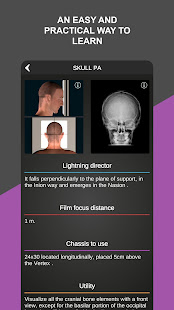 RX - Radiographic Positioning  Screenshots 3
