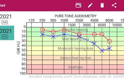 hearing test app android