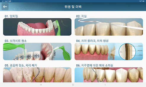 스크린샷 이미지