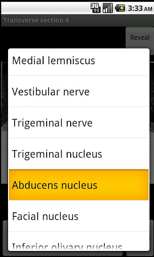 NeuroSlice Screen 3