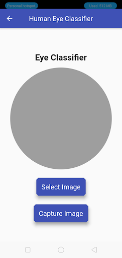 Human Eye Gender Classificatio