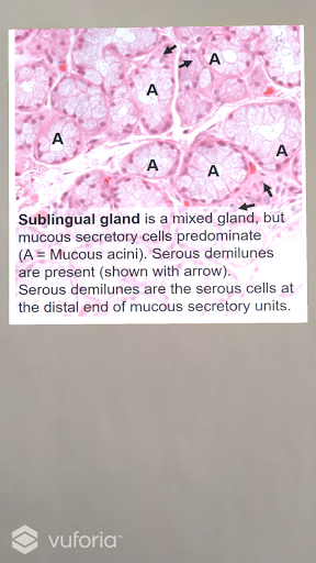Android application Dental AR screenshort