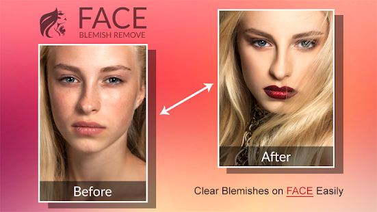Blemishes Remover You Makeup Screenshot
