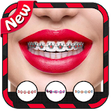 Braces For Teeth (Real Look) icon