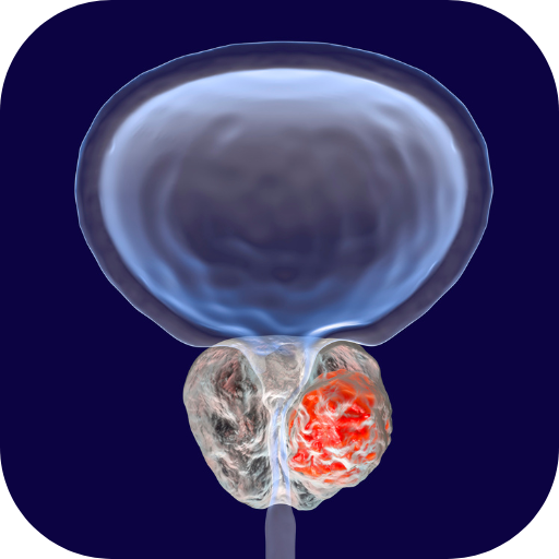 prostate treatment Download on Windows