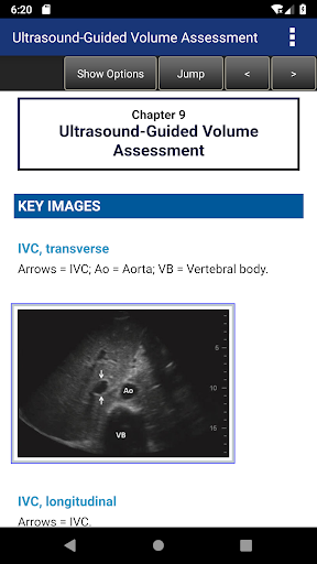 Pocket Guide to POCUS: Point-o Screen 3