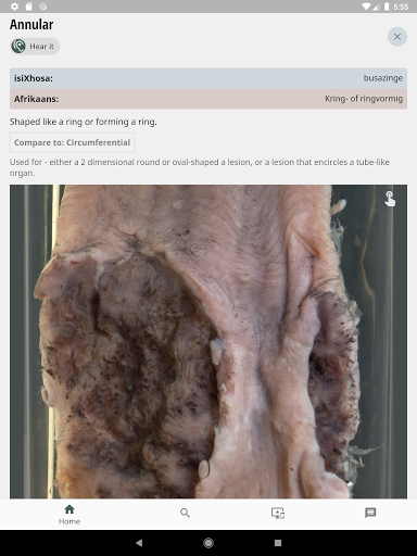 Pathology Lexicon A-Z