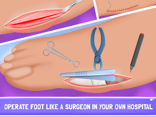 Nail Surgery Foot Doctor - Offline Surgeon Games 6.0 screenshots 4