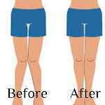 Cover Image of ดาวน์โหลด Legs straightening exercises  APK