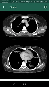CT Scan Anatomy