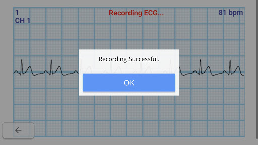 GEMS Mobile ECG Screen 2